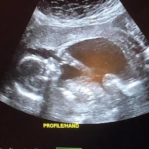 Meet your Posher, Jessie